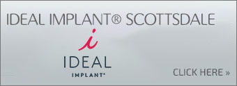Ideal Implant Scottsdale